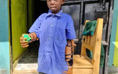 Changing Lives: impresión 3D para ayudar