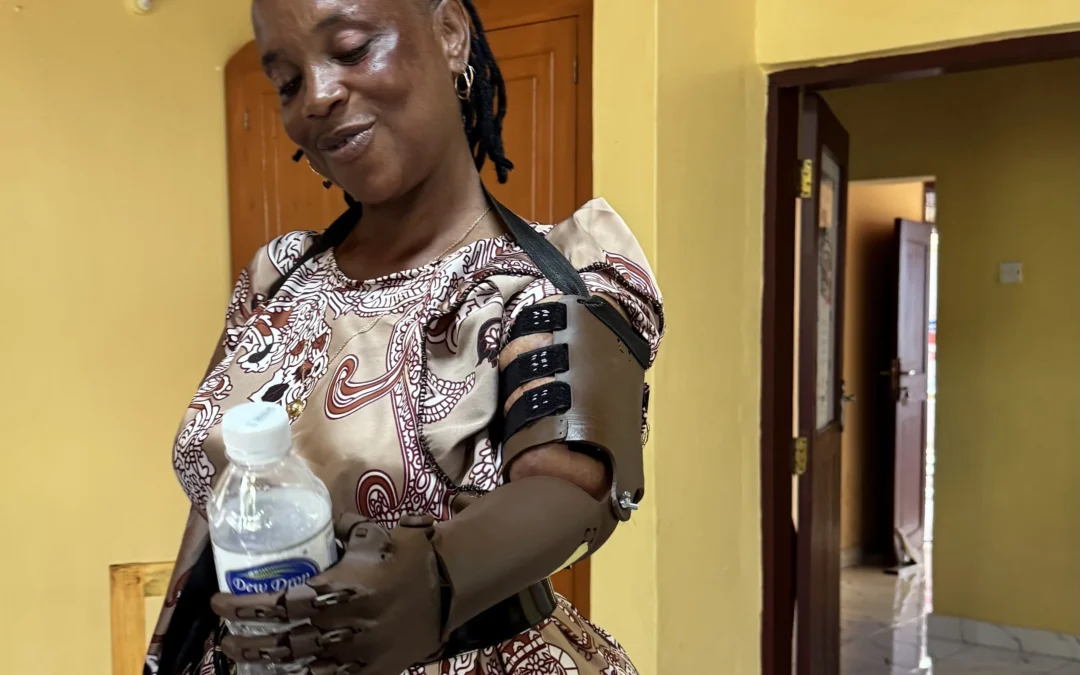 Ayúdame3D entrega las primeras prótesis creadas en su nuevo laboratorio tecnológico de Tanzania