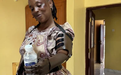 Ayúdame3D entrega las primeras prótesis creadas en su nuevo laboratorio tecnológico de Tanzania