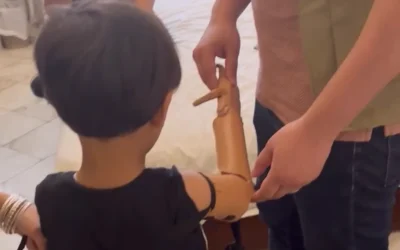 Llevamos las primeras prótesis a personas palestinas refugiadas en El Cairo