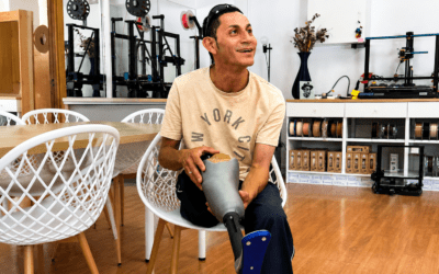 Nuestra prótesis de pierna: devolviendo la movilidad con impresión 3D